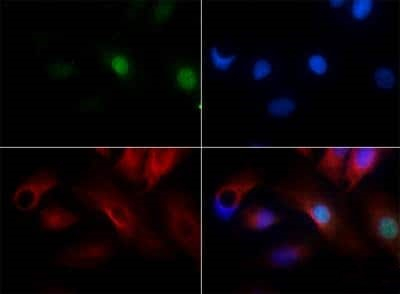 PLK5 Antibody in Immunocytochemistry (ICC/IF)