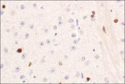 PIF1 Antibody in Immunohistochemistry (Paraffin) (IHC (P))