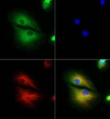 RP1 Antibody in Immunocytochemistry (ICC/IF)