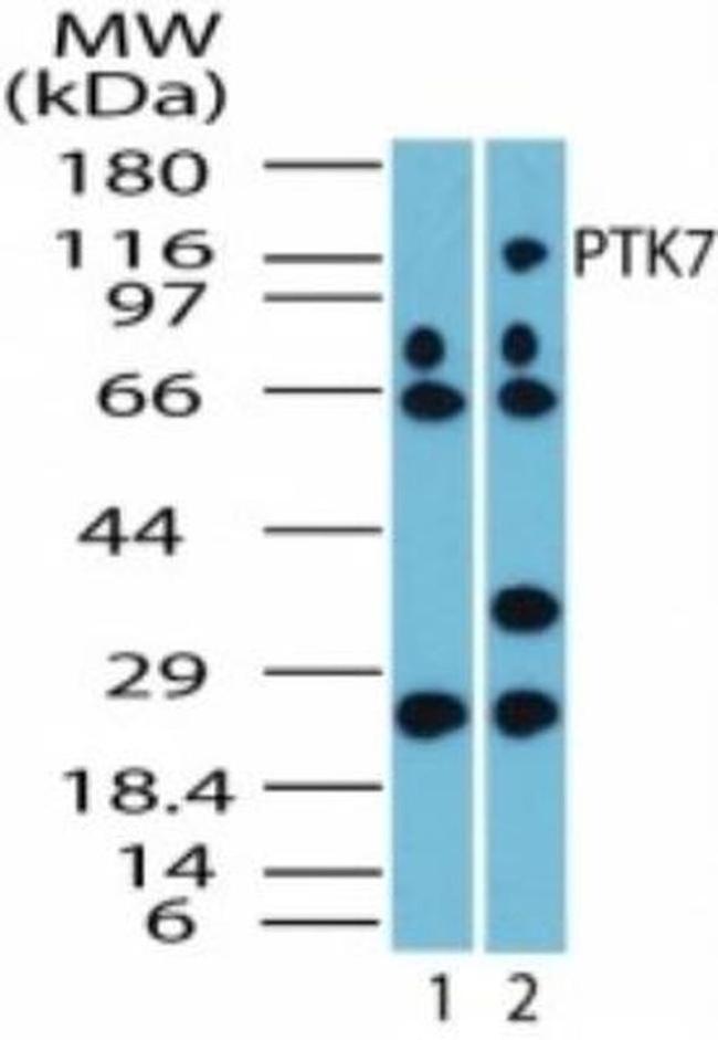 PTK7 Antibody in Western Blot (WB)