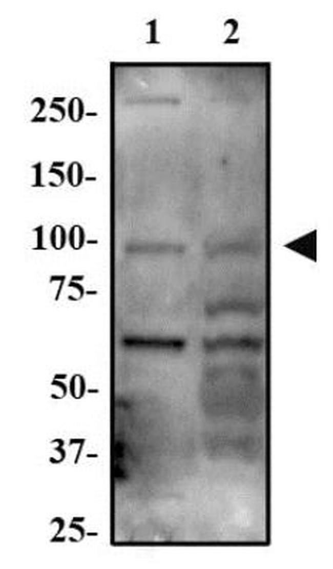 ARHGAP12 Antibody in Western Blot (WB)