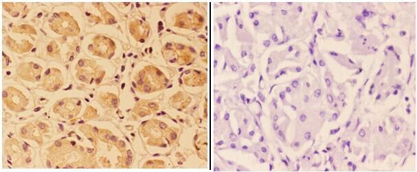 PTPRO Antibody in Immunohistochemistry (Paraffin) (IHC (P))