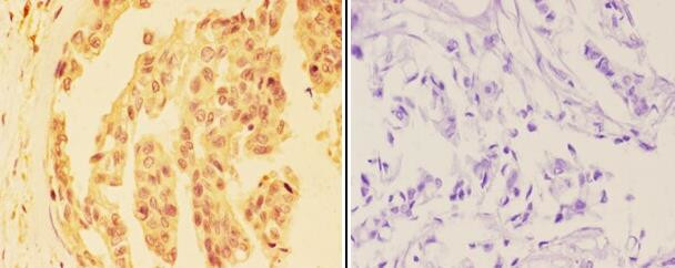 DHX36 Antibody in Immunohistochemistry (Paraffin) (IHC (P))