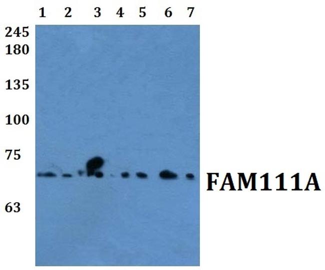 FAM111A Antibody in Western Blot (WB)