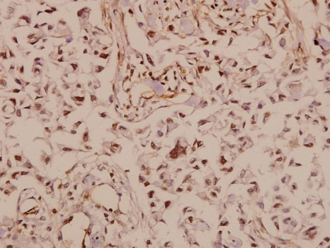 GLUT3 Antibody in Immunohistochemistry (Paraffin) (IHC (P))