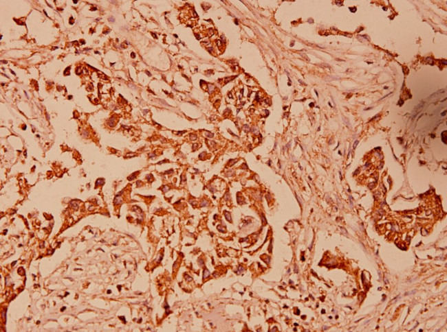HSPE1 Antibody in Immunohistochemistry (Paraffin) (IHC (P))