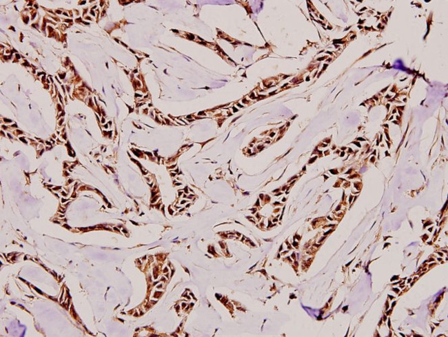CDKN2B Antibody in Immunohistochemistry (Paraffin) (IHC (P))