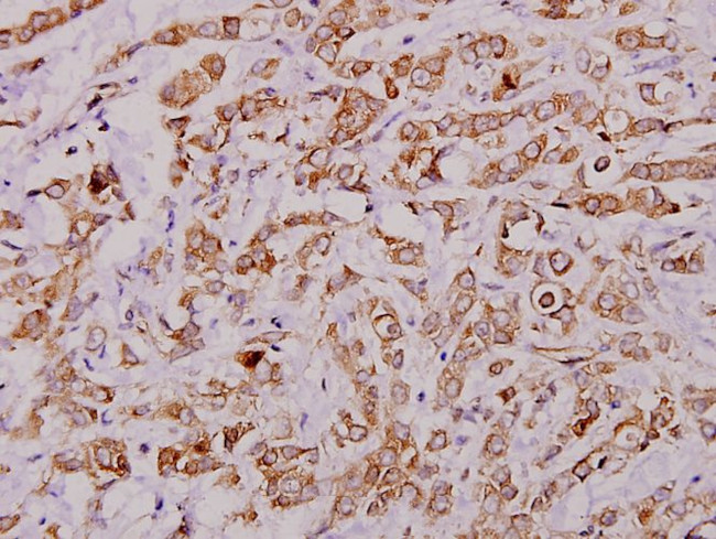 PLA2G4A Antibody in Immunohistochemistry (Paraffin) (IHC (P))