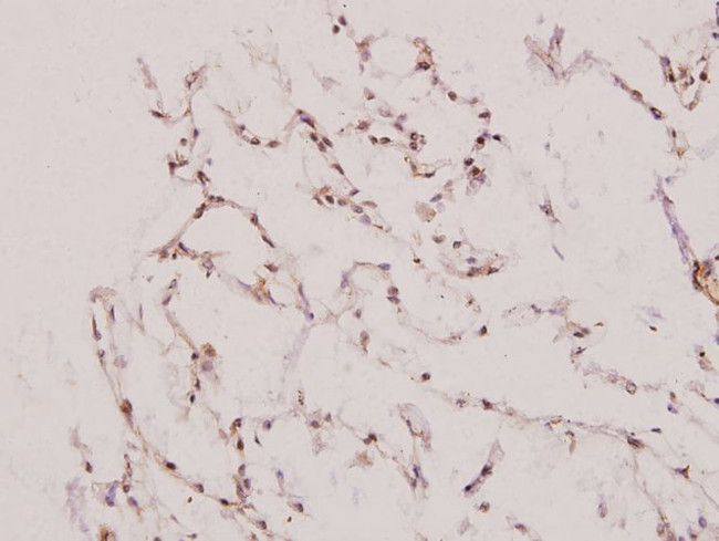 UBE1L Antibody in Immunohistochemistry (Paraffin) (IHC (P))