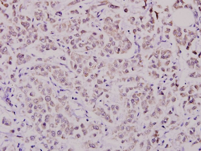 WAVE1 Antibody in Immunohistochemistry (Paraffin) (IHC (P))