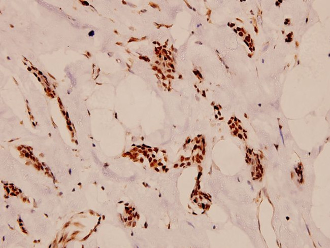 APC6 Antibody in Immunohistochemistry (Paraffin) (IHC (P))