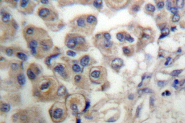 PLCB3 Antibody in Immunohistochemistry (Paraffin) (IHC (P))