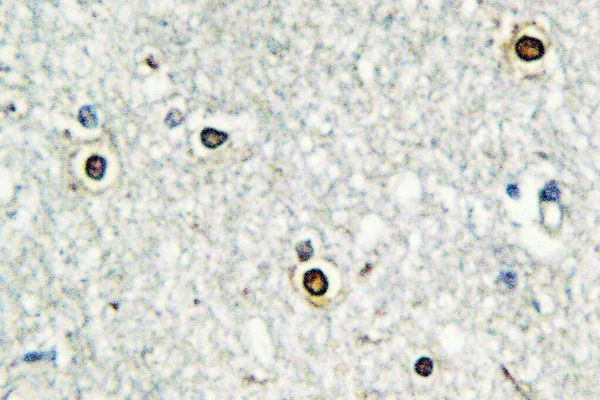 ATF7 Antibody in Immunohistochemistry (Paraffin) (IHC (P))