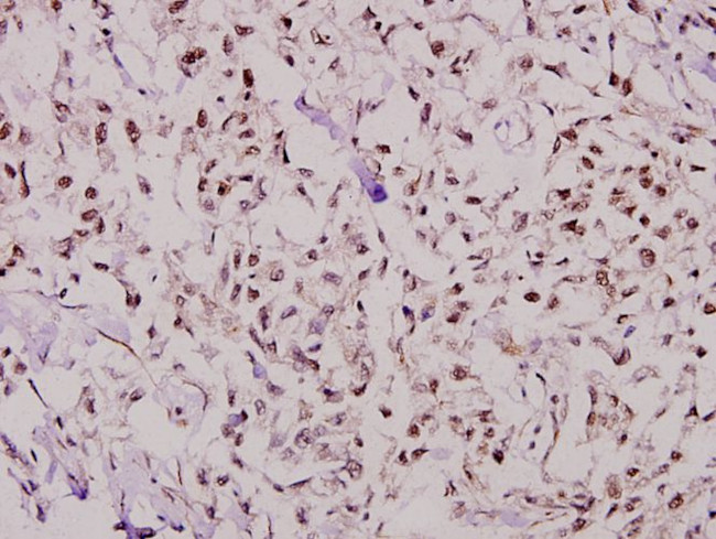 NFYB Antibody in Immunohistochemistry (Paraffin) (IHC (P))