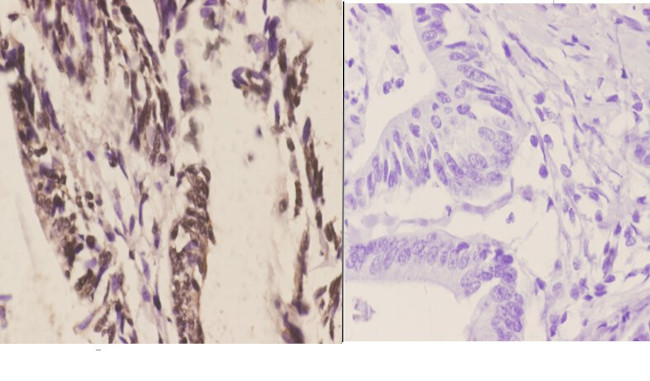 CSTF2 Antibody in Immunohistochemistry (Paraffin) (IHC (P))