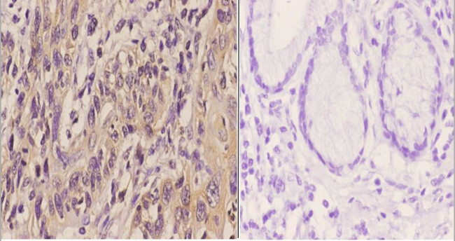 ETV6 Antibody in Immunohistochemistry (Paraffin) (IHC (P))
