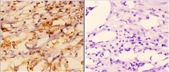 FXR2 Antibody in Immunohistochemistry (Paraffin) (IHC (P))