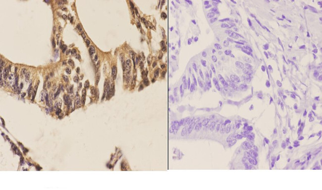 SP2 Antibody in Immunohistochemistry (Paraffin) (IHC (P))
