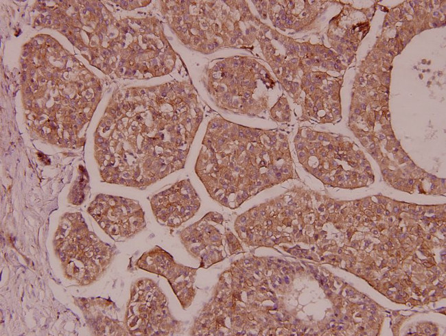 CREM Antibody in Immunohistochemistry (Paraffin) (IHC (P))