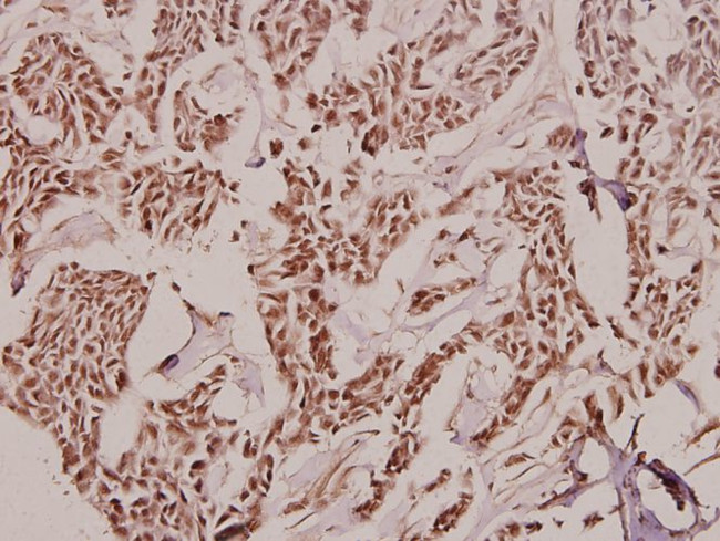 TCOF1 Antibody in Immunohistochemistry (Paraffin) (IHC (P))