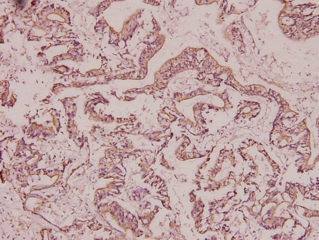 BRMS1 Antibody in Immunohistochemistry (Paraffin) (IHC (P))