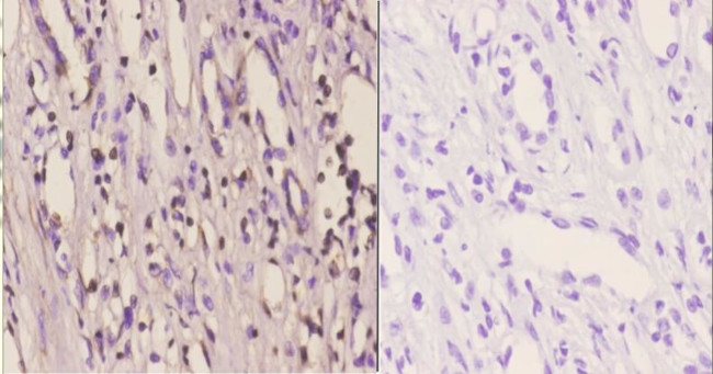 YBX2 Antibody in Immunohistochemistry (Paraffin) (IHC (P))