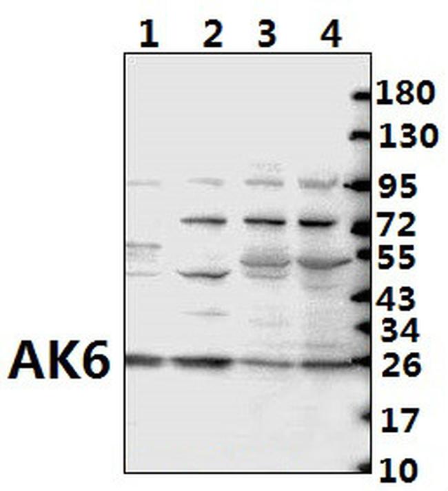 AK6 Antibody in Western Blot (WB)