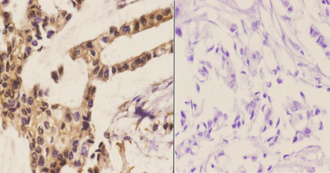 APC6 Antibody in Immunohistochemistry (Paraffin) (IHC (P))