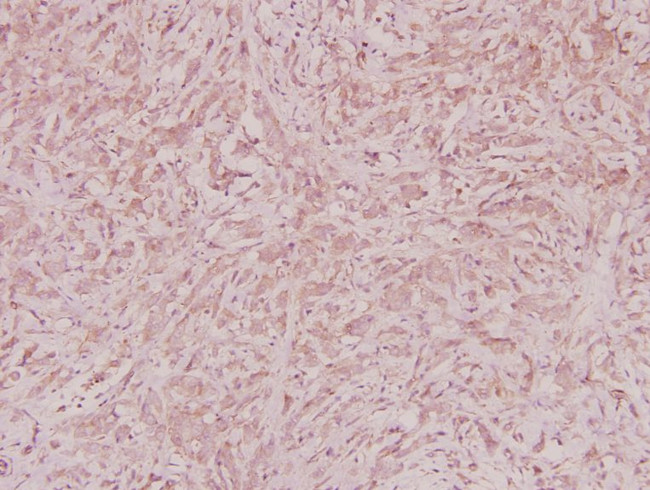 ZNF134 Antibody in Immunohistochemistry (Paraffin) (IHC (P))