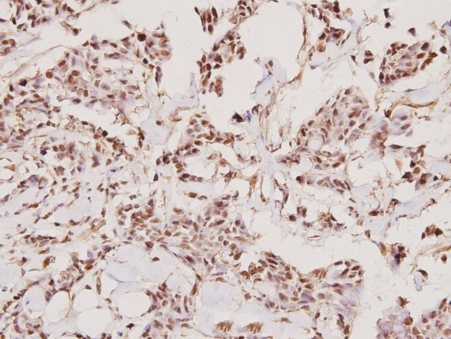 TMPRSS3 Antibody in Immunohistochemistry (Paraffin) (IHC (P))