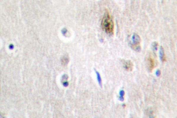 TRA2A Antibody in Immunohistochemistry (Paraffin) (IHC (P))