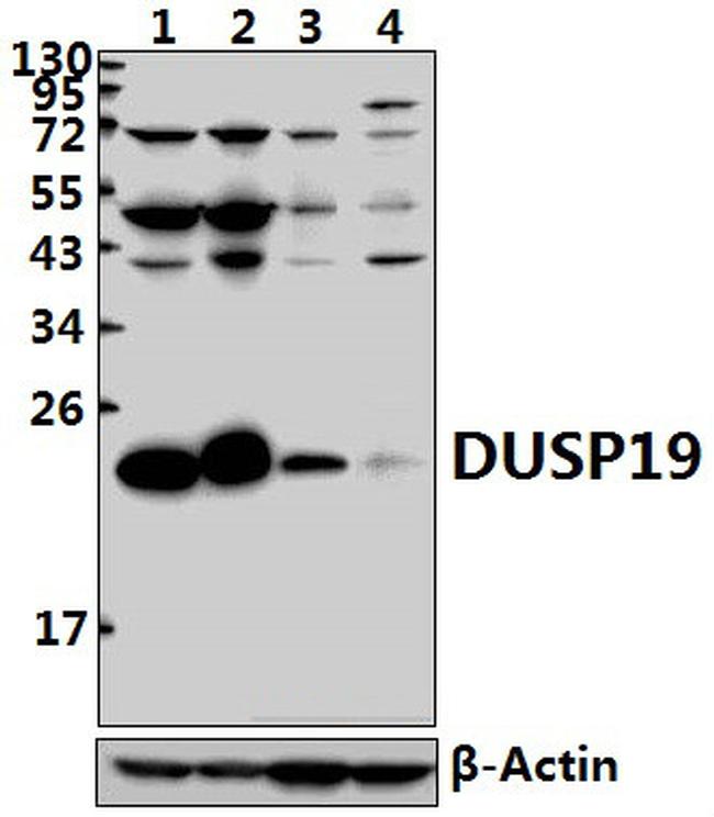 DUSP19 Antibody in Western Blot (WB)