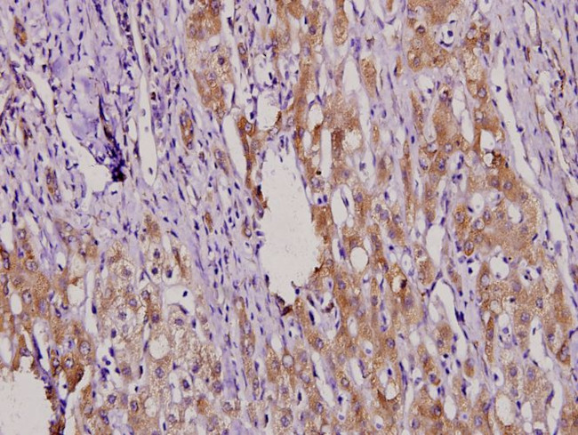 MKP4 Antibody in Immunohistochemistry (Paraffin) (IHC (P))