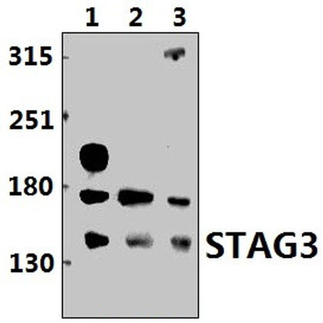 STAG3 Antibody in Western Blot (WB)