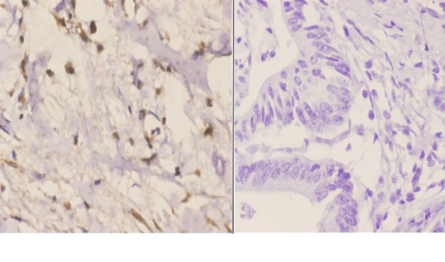RAD51C Antibody in Immunohistochemistry (Paraffin) (IHC (P))