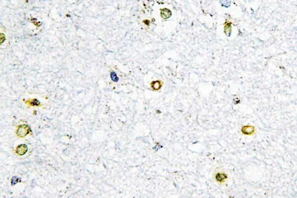 TRIM24 Antibody in Immunohistochemistry (Paraffin) (IHC (P))