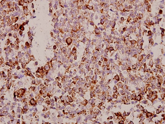 TSPAN8 Antibody in Immunohistochemistry (Paraffin) (IHC (P))