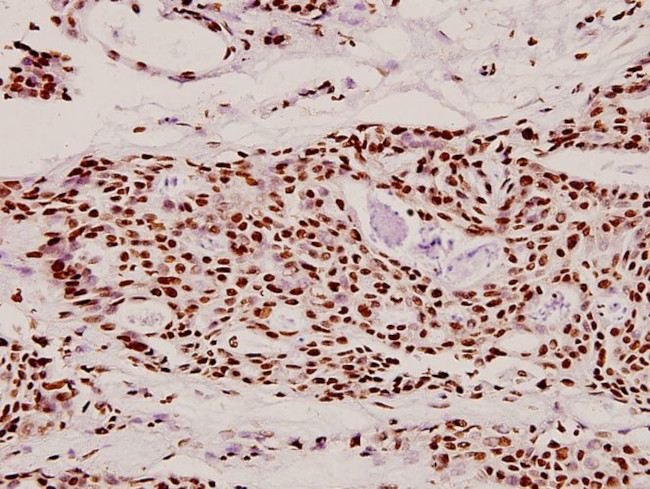 DLX4 Antibody in Immunohistochemistry (Paraffin) (IHC (P))