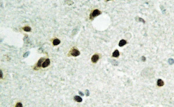 HIST1H2BH Antibody in Immunohistochemistry (Paraffin) (IHC (P))