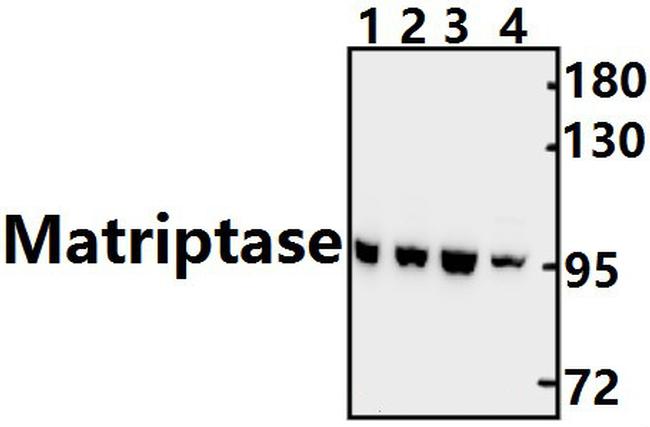 ST14 Antibody in Western Blot (WB)