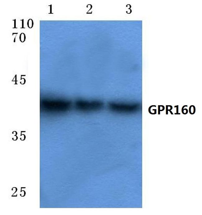 GPR160 Antibody in Western Blot (WB)