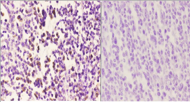 CAF1 p60 Antibody in Immunohistochemistry (Paraffin) (IHC (P))