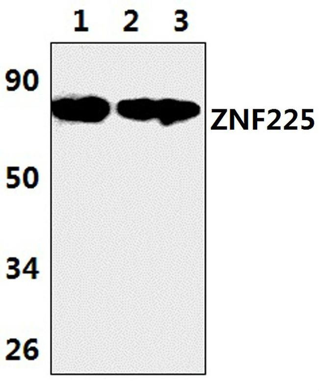 ZNF225 Antibody in Western Blot (WB)