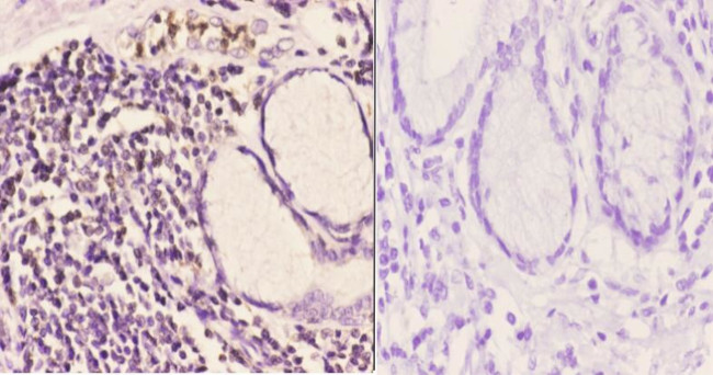IP6K2 Antibody in Immunohistochemistry (Paraffin) (IHC (P))