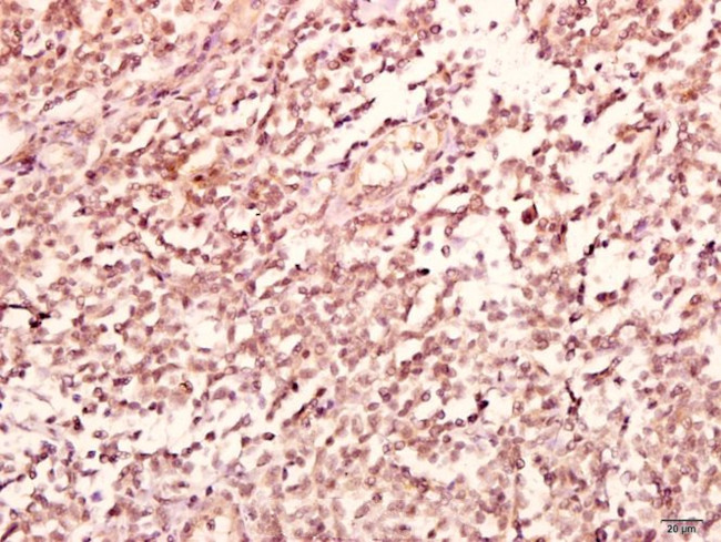 GABRB2 Antibody in Immunohistochemistry (Paraffin) (IHC (P))