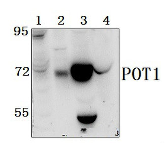 POT1 Antibody in Western Blot (WB)