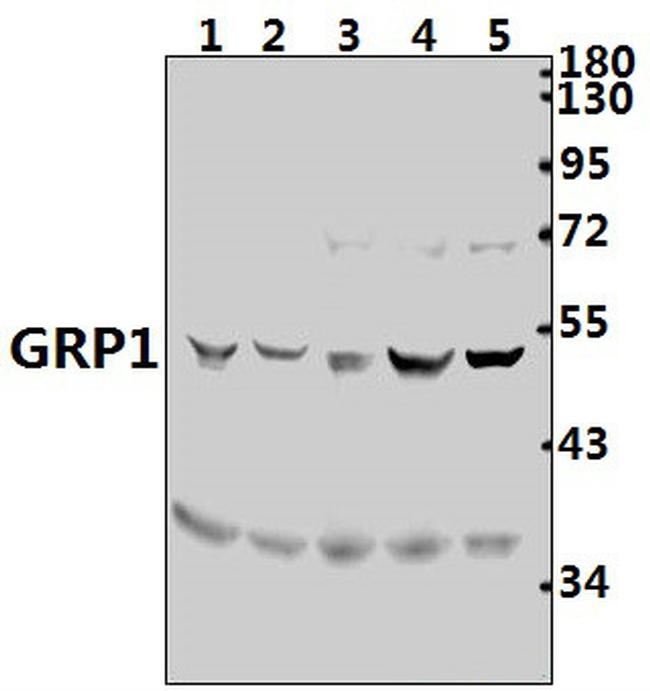 Cytohesin 3 Antibody in Western Blot (WB)