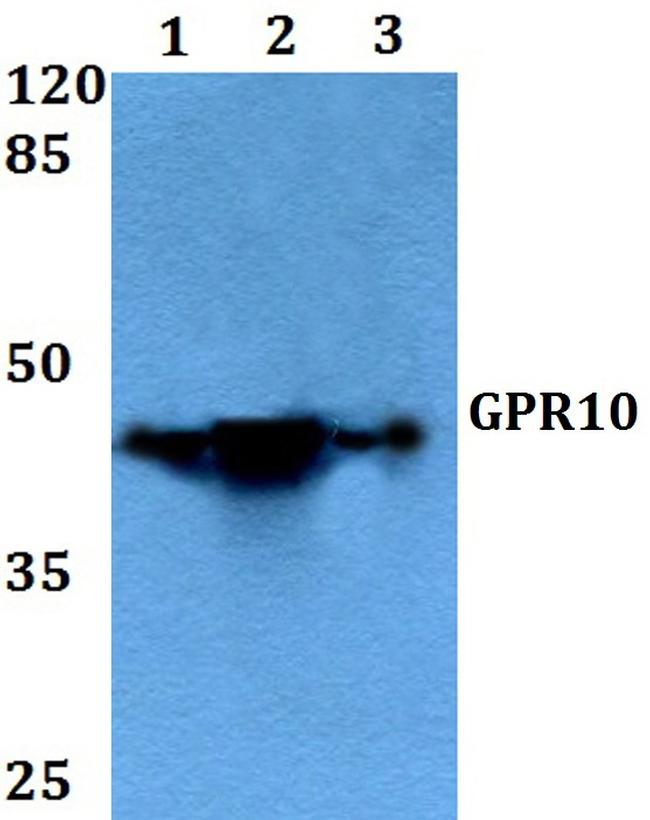GPR10 Antibody in Western Blot (WB)