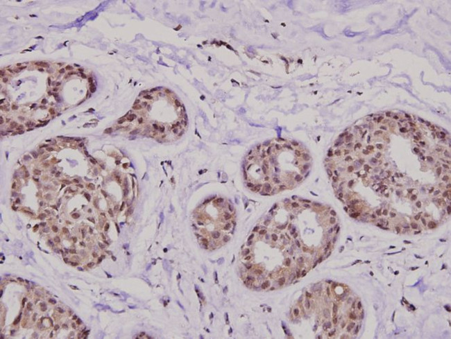 KIF20A Antibody in Immunohistochemistry (Paraffin) (IHC (P))