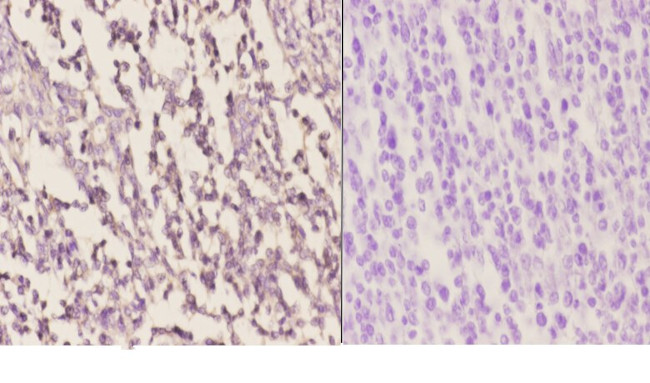 HCCS Antibody in Immunohistochemistry (Paraffin) (IHC (P))